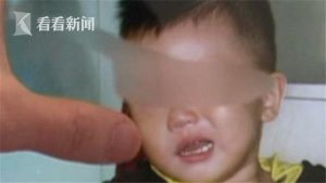 Bé trai 2 tuổi bị liệt mặt vì nằm điều hòa cả đêm